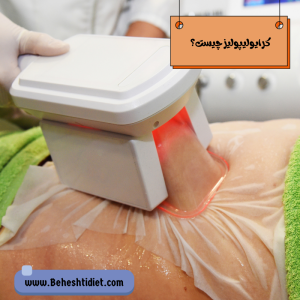 کرایولیپولیز چیست؟